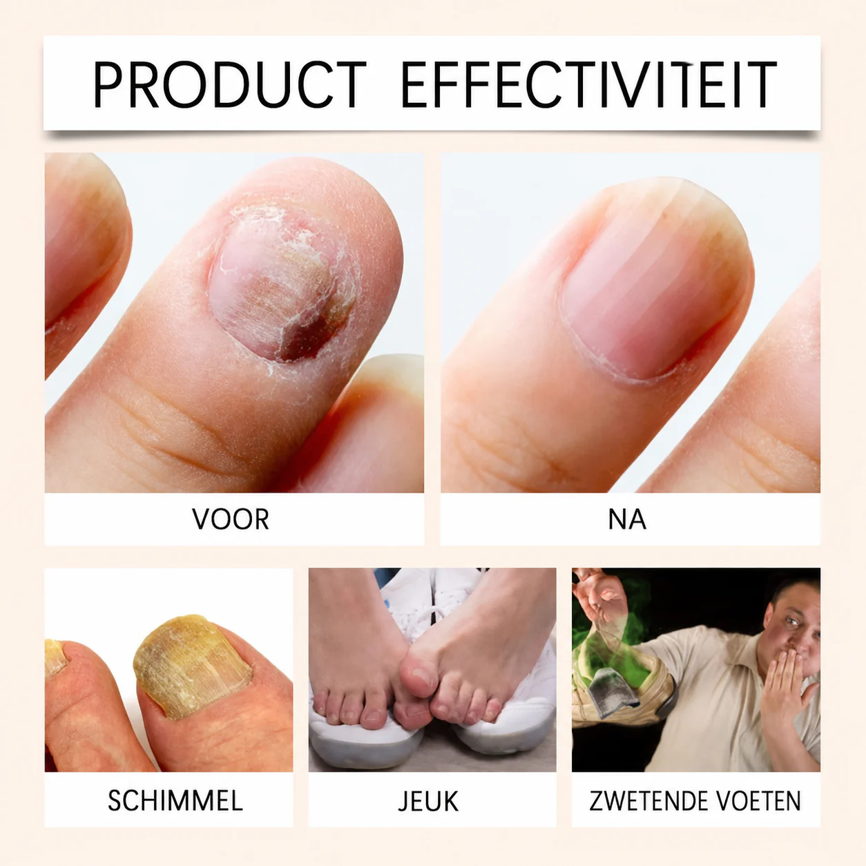 Bijengif Nagelspray